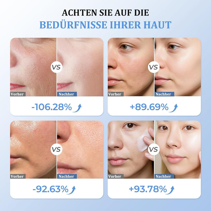 Oranmagic EMS Light Therapy Device, Electric Facial Massager, Anti-Wrinkle Skincare, Reduces Wrinkles and Fine Lines